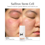 Dry & Aging Skin Bundle