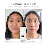 Dry & Aging Skin Bundle