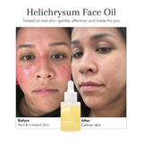 Dry & Aging Skin Bundle