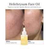 Dry & Aging Skin Bundle