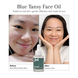 Oily & Acne Bundle