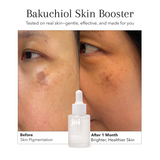 Redness & Sensitivity Bundle