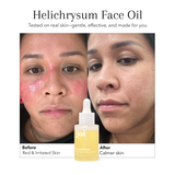Redness & Sensitivity Bundle