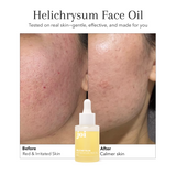 Redness & Sensitivity Bundle