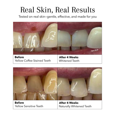 Coconut Natural Toothpaste